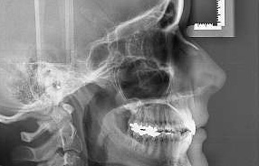 fogorvos, fogászat, fogászat pécs, eurodental, szájsebészet, röntgen, digitális röntgen