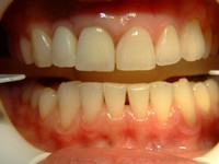 fogorvos, fogászat, fogászat pécs, eurodental, szájsebészet, fogfehérítés, fehér fog