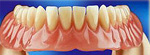 dentist pecs, dental, fogorvos, fogászat, fogászat pécs, eurodental, szájsebészet, protézisek