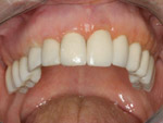 dental implant, pécs, dentist pecs, fogorvos pécs, fogorvos pecs, fogászati ügyelet pécs