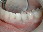 implant, dental, pécs, ungarn, fogorvos pécs, fogorvosi ügyelet pécs